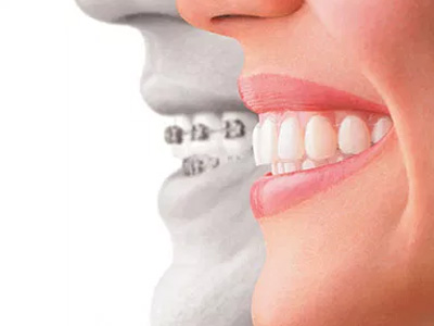 Dental Smiles of Joliet | Emergency Treatment, Orthodontics and Oral Exams
