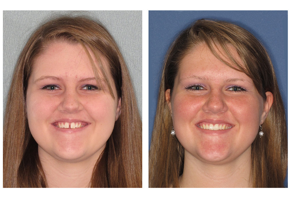 Dental Smiles of Joliet