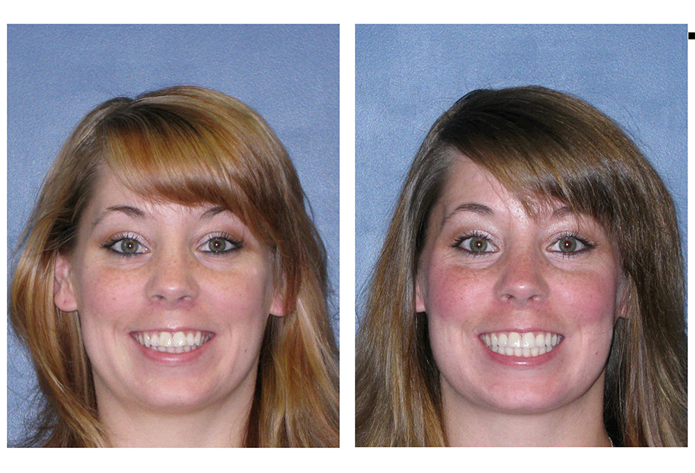 Dental Smiles of Joliet