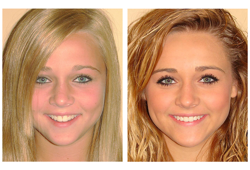 Dental Smiles of Joliet