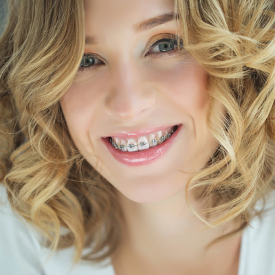Smiling woman with braces, wearing a white top and curly hair.