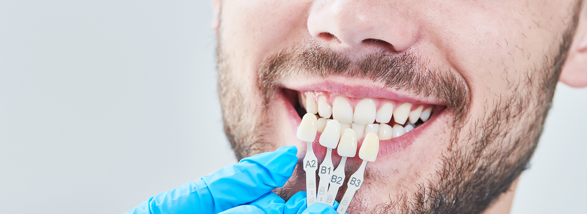 This image features a man with a toothy smile, wearing blue gloves and holding a dental implant with a screw in his hand.