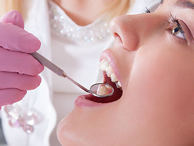 An image of a dental professional performing oral care on a patient, with the focus on the dental work being done.