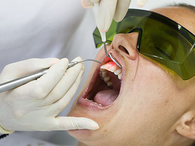 A person receiving dental care, with a dentist using a drill on their teeth and wearing protective eyewear.